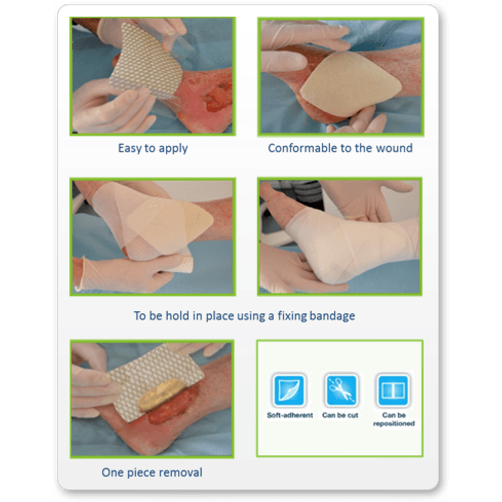 Pensos de Fibras PoliAbsorventes e Prata UrgoClean Ag
